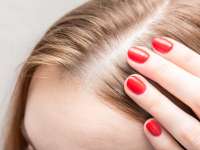 Népbetegségek hajkorona terén: hajhullás és seborrhea